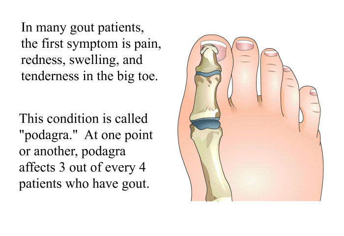 In many gout patients, the first symptom is pain, redness, swelling, and tenderness in the big toe. This condition is called &ldquo;podagra.&rdquo; At one point or another, podagra affects 3 out of every 4 patients who have gout.