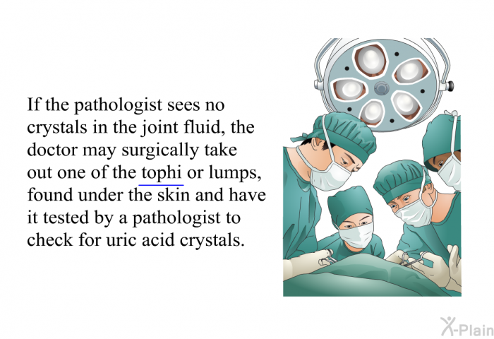 If the pathologist sees no crystals in the joint fluid, the doctor may surgically take out one of the tophi or lumps, found under the skin and have it tested by a pathologist to check for uric acid crystals.