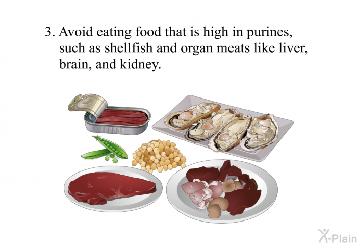 Avoid eating food that is high in purines, such as shellfish and organ meats like liver, brain, and kidney.