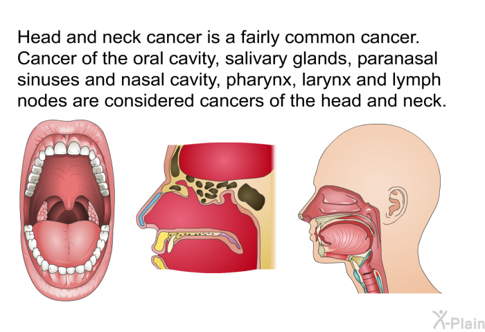 Head and neck cancer is a fairly common cancer. Cancer of the oral cavity, salivary glands, paranasal sinuses and nasal cavity, pharynx, larynx, and lymph nodes are considered cancers of the head and neck.