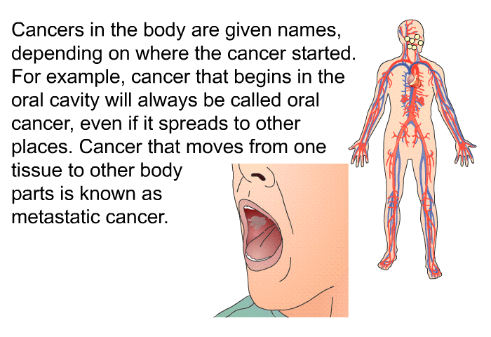 Cancers in the body are given names, depending on where the cancer started. For example, cancer that begins in the oral cavity will always be called oral cancer, even if it spreads to other places. Cancer that moves from one tissue to other body parts is known as metastatic cancer