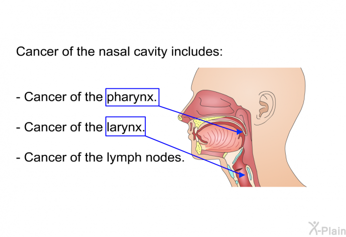 Cancer of the nasal cavity includes:  Cancer of the pharynx. Cancer of the larynx. Cancer of the lymph nodes.