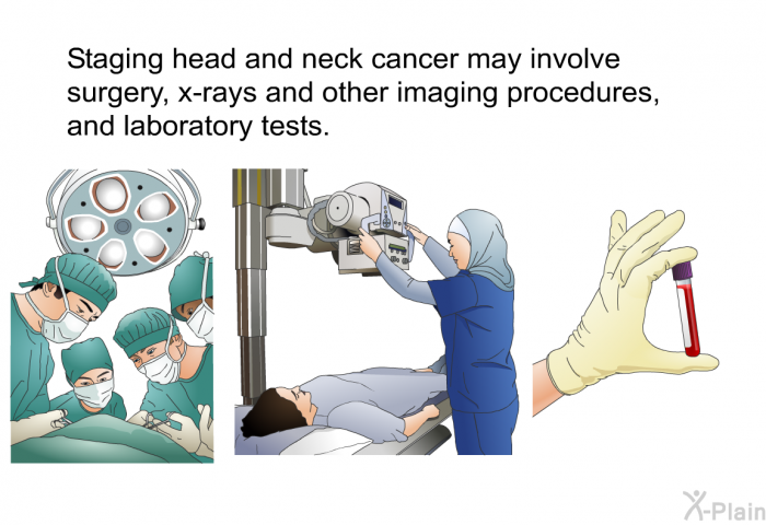 Staging head and neck cancer may involve surgery, x-rays and other imaging procedures, and laboratory tests.