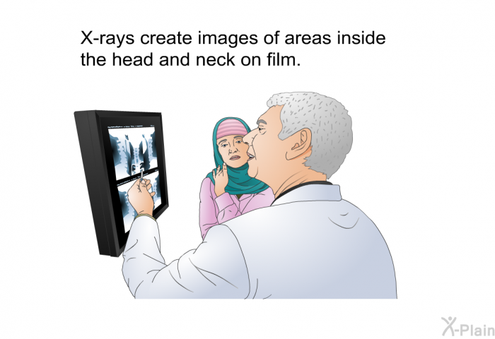 X-rays create images of areas inside the head and neck on film.