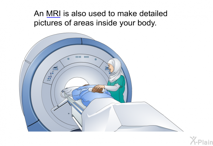 An MRI is also used to make detailed pictures of areas inside your body.