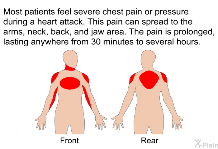 Most patients feel severe chest pain or pressure during a heart attack. This pain can spread to the arms, neck, back, and jaw area. The pain is prolonged, lasting anywhere from 30 minutes to several hours.