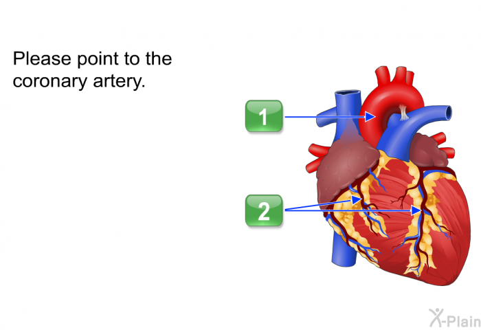 Please point to the coronary artery.