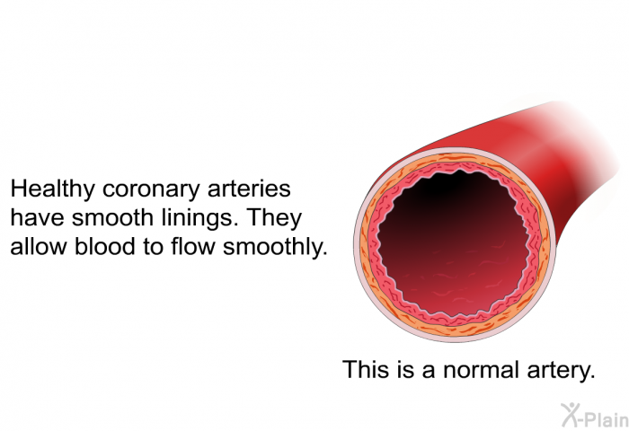 Healthy coronary arteries have smooth linings. They allow blood to flow smoothly.