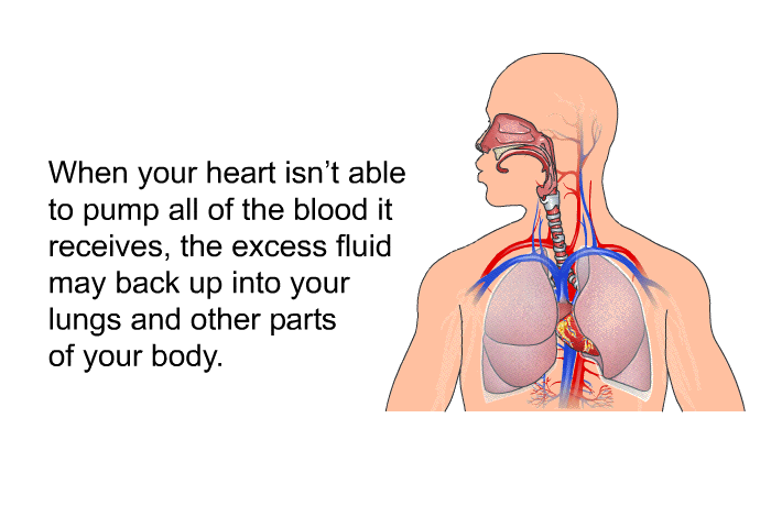 When your heart isn't able to pump all of the blood it receives, the excess fluid may back up into your lungs and other parts of your body.