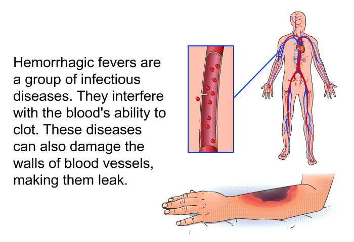 Hemorrhagic fevers are a group of infectious diseases. They interfere with the blood's ability to clot. These diseases can also damage the walls of blood vessels, making them leak.