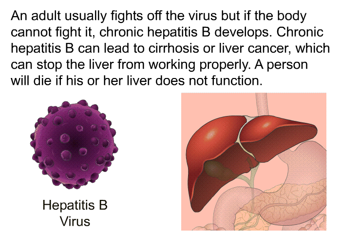 An adult usually fights off the virus but if the body cannot fight it, chronic hepatitis B develops. Chronic hepatitis B can lead to cirrhosis or liver cancer, which can stop the liver from working properly. A person will die if his or her liver does not function.