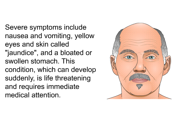 Severe symptoms include nausea and vomiting, yellow eyes and skin called “jaundice”, and a bloated or swollen stomach. This condition, which can develop suddenly, is life threatening and requires immediate medical attention.