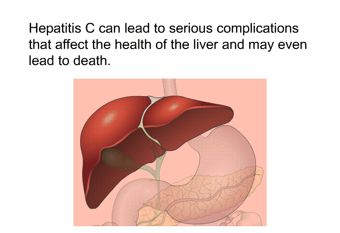 Hepatitis C can lead to serious complications that affect the health of the liver and may even lead to death.