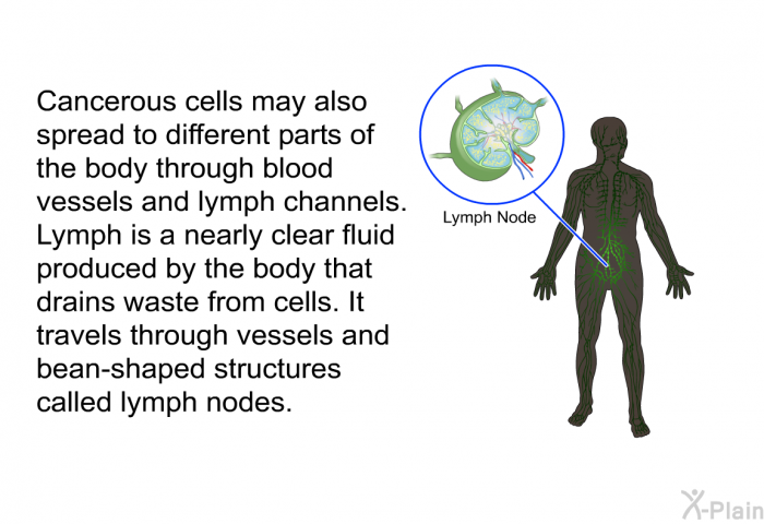 Cancerous cells may also spread to different parts of the body through blood vessels and lymph channels. Lymph is a nearly clear fluid produced by the body that drains waste from cells. It travels through vessels and bean-shaped structures called lymph nodes.