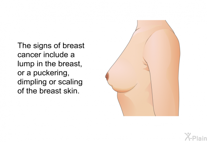 The signs of breast cancer include a lump in the breast, or a puckering, dimpling or scaling of the breast skin.