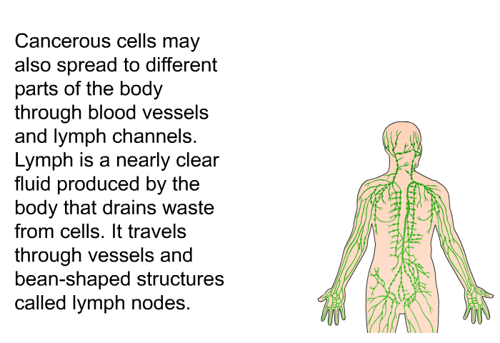 Cancerous cells may also spread to different parts of the body through blood vessels and lymph channels. Lymph is a nearly clear fluid produced by the body that drains waste from cells. It travels through vessels and bean-shaped structures called lymph nodes.