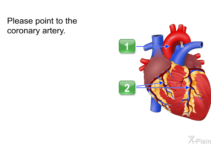Please point to the coronary artery.