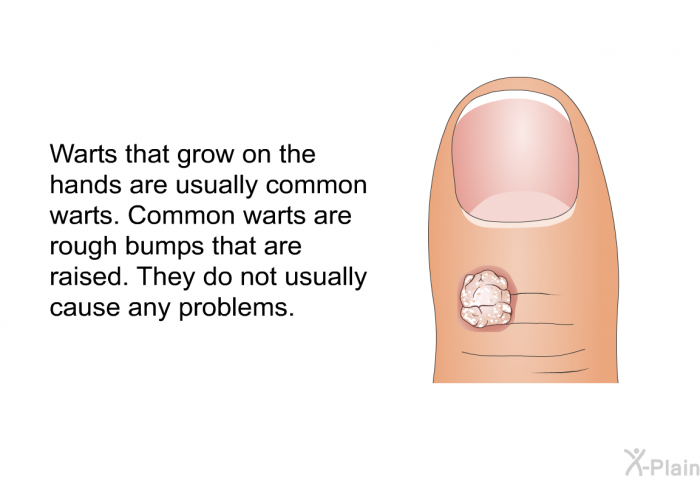 Warts that grow on the hands are usually common warts. Common warts are rough bumps that are raised. They do not usually cause any problems.
