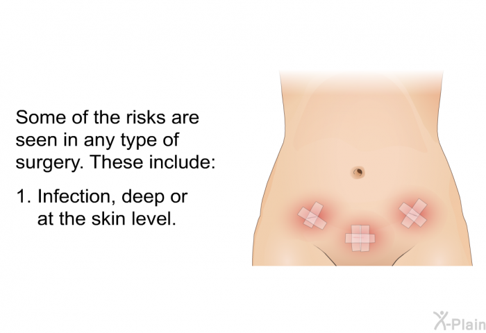 Some of the risks are seen in any type of surgery. These include:  Infection, deep or at the skin level.