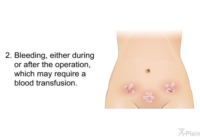 Bleeding, either during or after the operation, which may require a blood transfusion.