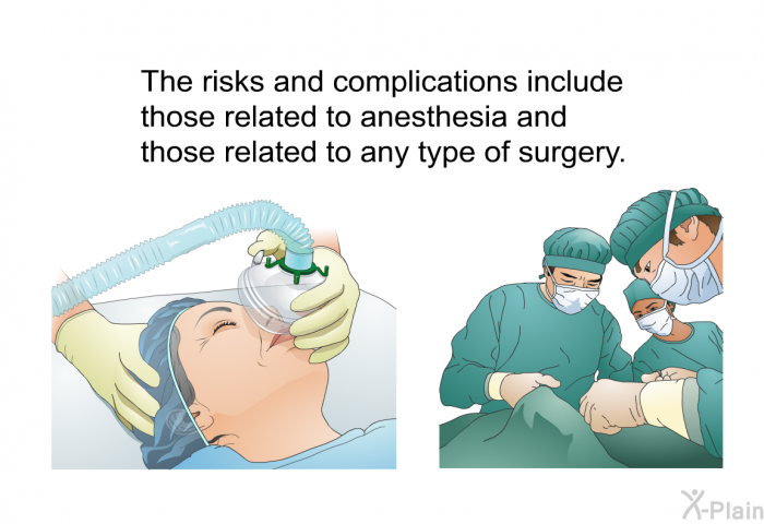 The risks and complications include those related to anesthesia and those related to any type of surgery.