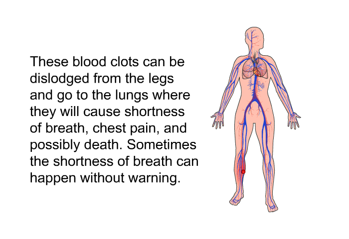 These blood clots can be dislodged from the legs and go to the lungs where they will cause shortness of breath, chest pain, and possibly death. Sometimes the shortness of breath can happen without warning.