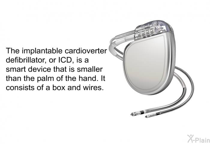 The implantable cardioverter defibrillator, or ICD, is a smart device that is smaller than the palm of the hand. It consists of a box and wires.