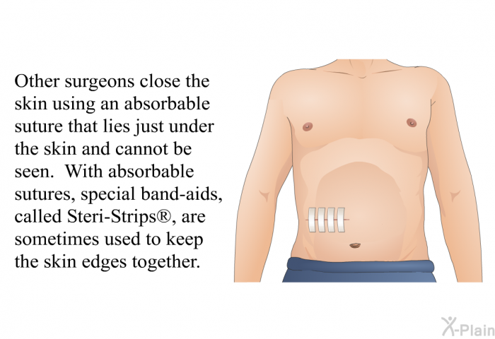 Other surgeons close the skin using an absorbable suture that lies just under the skin and cannot be seen. With absorbable sutures, special band-aids, called Steri-Strips , are sometimes used to keep the skin edges together.