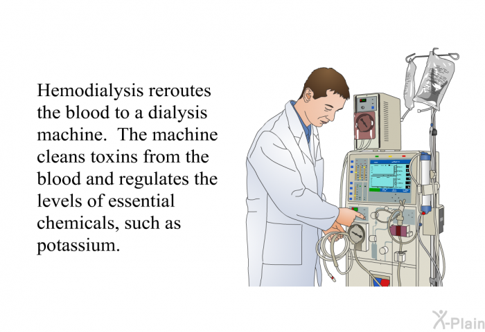 Hemodialysis reroutes the blood to a dialysis machine. The machine cleans toxins from the blood and regulates the levels of essential chemicals, such as potassium.