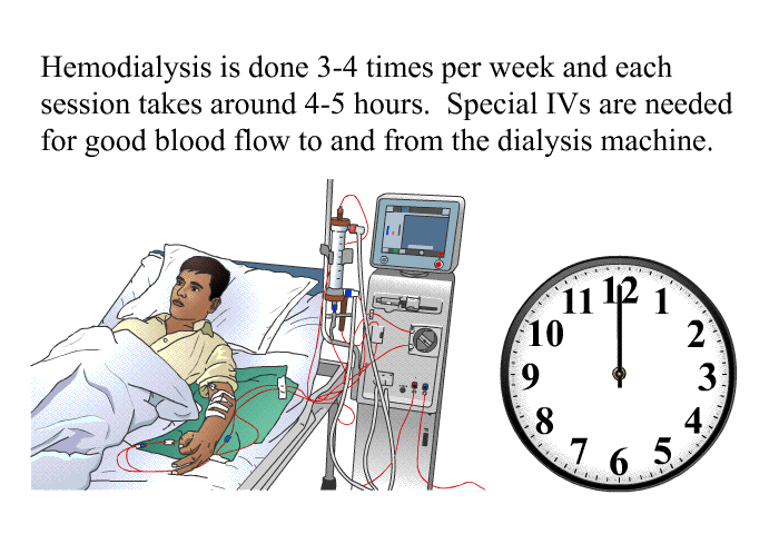 Hemodialysis is done 3-4 times per week and each session takes around 4-5 hours. Special IVs are needed for good blood flow to and from the dialysis machine.