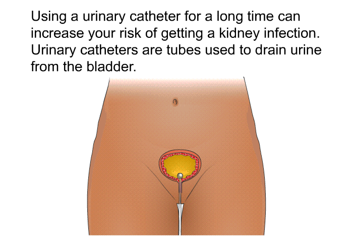 Using a urinary catheter for a long time can increase your risk of getting a kidney infection. Urinary catheters are tubes used to drain urine from the bladder.