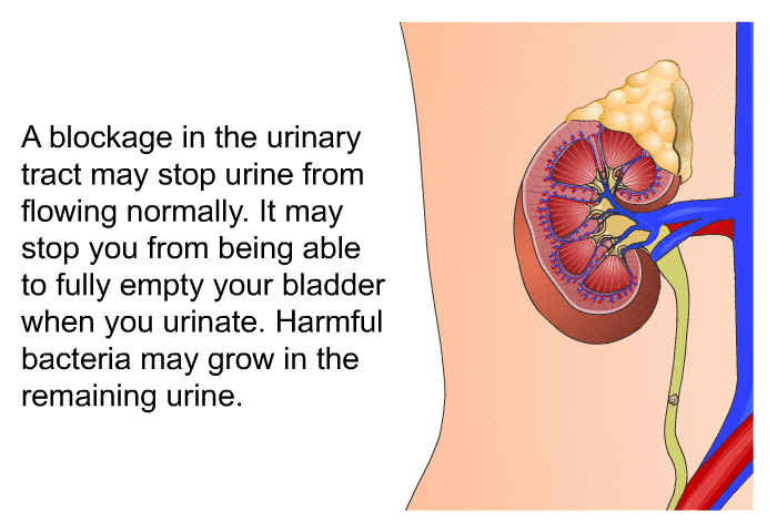 A blockage in the urinary tract may stop urine from flowing normally. It may stop you from being able to fully empty your bladder when you urinate. Harmful bacteria may grow in the remaining urine.