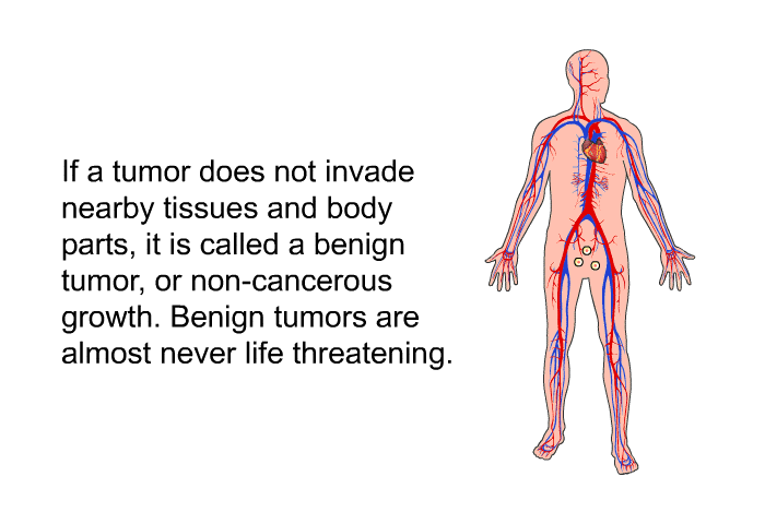 If a tumor does not invade nearby tissues and body parts, it is called a benign tumor, or non-cancerous growth. Benign tumors are almost never life threatening.