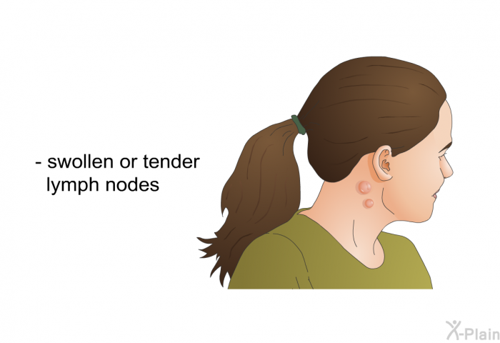 swollen or tender lymph<I> </I>nodes