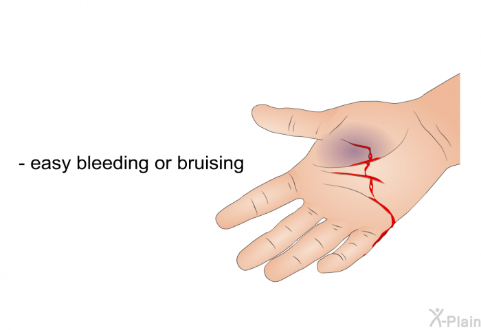 easy bleeding or bruising