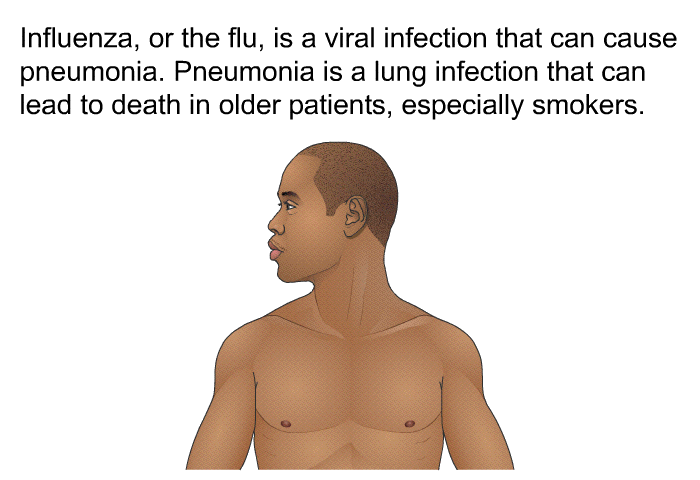 Influenza, or the flu, is a viral infection that can cause pneumonia. Pneumonia is a lung infection that can lead to death in older patients, especially smokers.