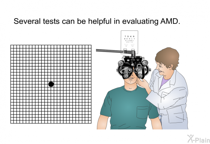 Several tests can be helpful in evaluating AMD.