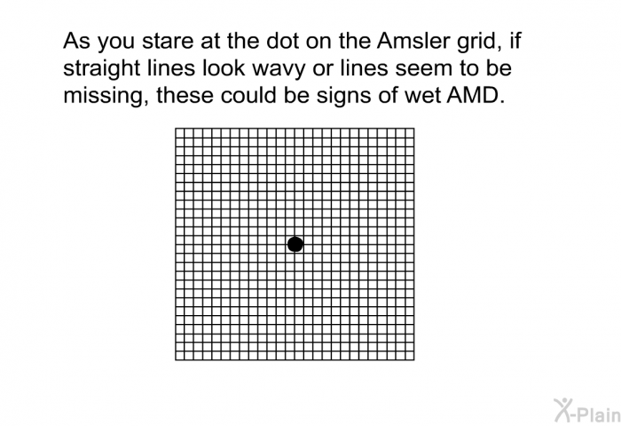 As you stare at the dot on the Amsler grid, if straight lines look wavy or lines seem to be missing, these could be signs of wet AMD.