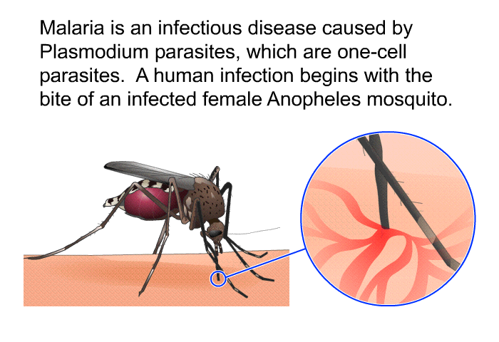 Malaria is an infectious disease caused by Plasmodium parasites, which are one-cell parasites. A human infection begins with the bite of an infected female Anopheles mosquito.