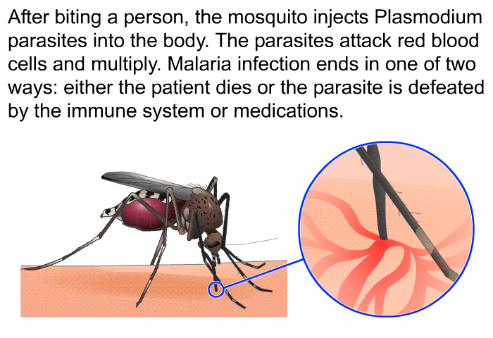 After biting a person, the mosquito injects Plasmodium parasites into the body. The parasites attack red blood cells and multiply. Malaria infection ends in one of two ways: either the patient dies or the parasite is defeated by the immune system or medications.