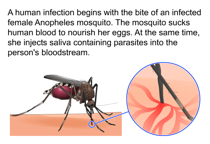 A human infection begins with the bite of an infected female Anopheles mosquito. The mosquito sucks human blood to nourish her eggs. At the same time, she injects saliva containing parasites into the person's bloodstream.