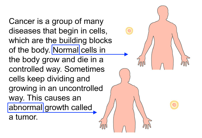 Cancer is a group of many diseases that begin in cells, which are the building blocks of the body. Normal cells in the body grow and die in a controlled way. Sometimes cells keep dividing and growing in an uncontrolled way. This causes an abnormal growth called a tumor.