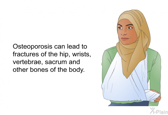 Osteoporosis can lead to fractures of the hip, wrists, vertebrae, sacrum and other bones of the body.