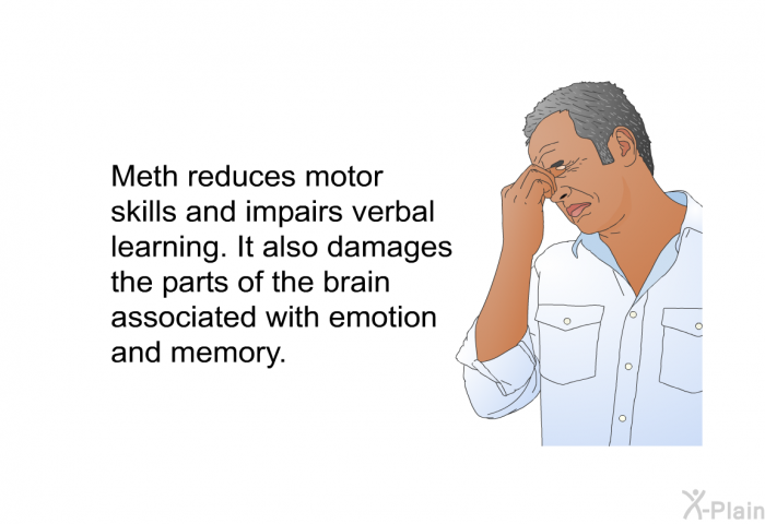 Meth reduces motor skills and impairs verbal learning. It also damages the parts of the brain associated with emotion and memory.