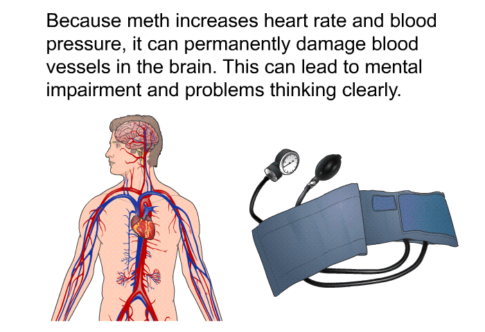Because meth increases heart rate and blood pressure, it can permanently damage blood vessels in the brain. This can lead to mental impairment and problems thinking clearly.