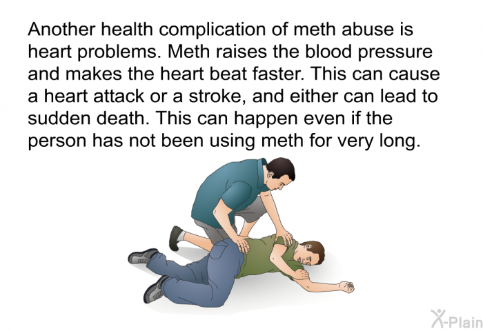 Another health complication of meth abuse is heart problems. Meth raises the blood pressure and makes the heart beat faster. This can cause a heart attack or a stroke, and either can lead to sudden death. This can happen even if the person has not been using meth for very long.
