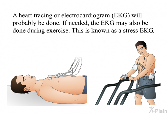 A heart tracing or electrocardiogram (EKG) will probably be done. If needed, the EKG may also be done during exercise. This is known as a stress EKG.