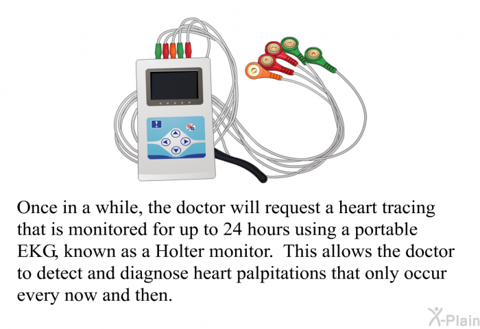 Once in a while, the doctor will request a heart tracing that is monitored for up to 24 hours using a portable EKG, known as a Holter monitor. This allows the doctor to detect and diagnose heart palpitations that only occur every now and then.