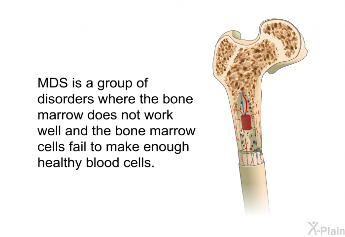 MDS is a group of disorders where the bone marrow does not work well and the bone marrow cells fail to make enough healthy blood cells.