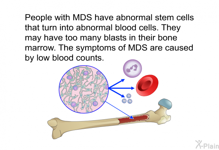 People with MDS have abnormal stem cells that turn into abnormal blood cells. They may have too many blasts in their bone marrow. The symptoms of MDS are caused by low blood counts.